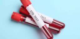 Tubes with blood samples and labels STD Test on light blue background