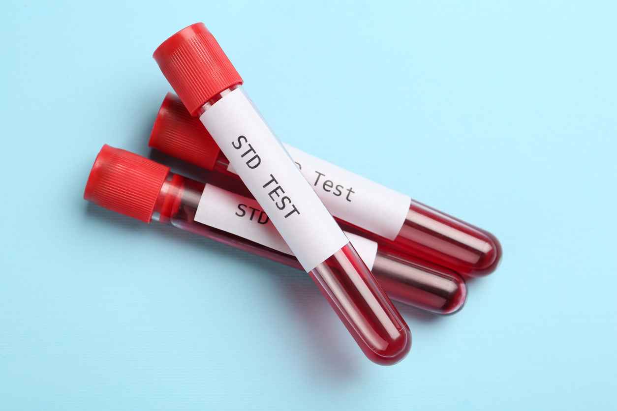Tubes with blood samples and labels STD Test on light blue background