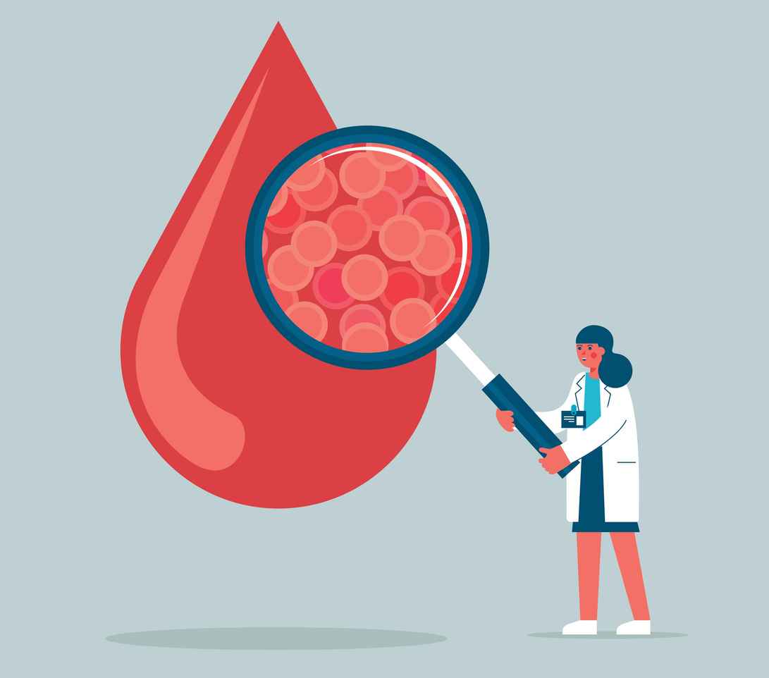 Doctor diagnose human blood Vessel